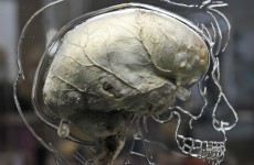 Brain power begins to decline from age 45 – study