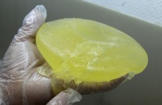 Former head of breast implant company PIP arrested in France