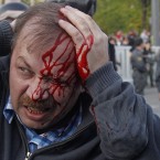 A wounded opposition protester winces in pain during a rally in Moscow on Sunday, May 6, 2012. Riot police in Moscow have begun arresting protesters who were trying to reach the Kremlin in a demonstration on the eve of Vladimir Putin's inauguration as president. (AP Photo/Mikhail Metzel)