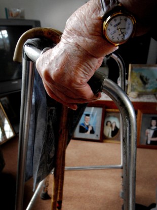 File photo of a rheumatoid arthritis suffer
