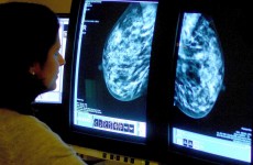 Irish Cancer Society announces €7.5 million funding for research centre