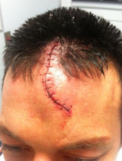 Your It’s Just A Scratch Picture Of The Day