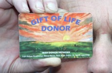 Poll: Should Ireland move to an ‘opt out’ system for organ donation?