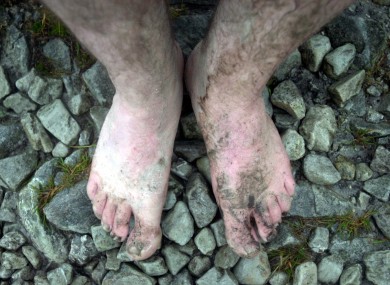 The feet of people who went bare foot on their annual climb of Croagh Patrick in 2002.